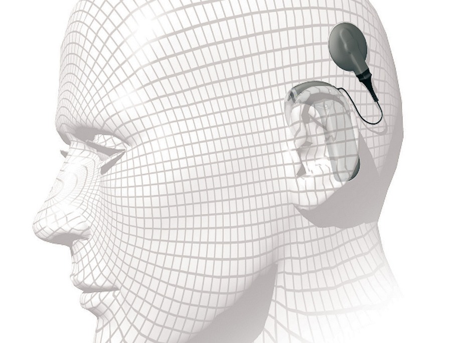cochlear